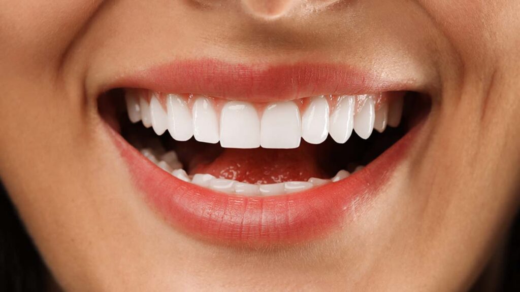 Digital Smile Design: The Future of Smile Makeover in Kolhapur