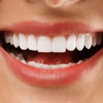 Digital Smile Design: The Future of Smile Makeover in Kolhapur