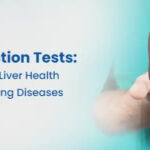 Liver Function Test in Hyderabad – Accurate LFT Testing at Sprint Diagnostics