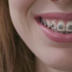 How Braces Treatment Improves More Than Just Your Smile