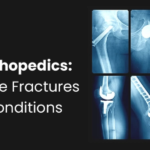 Digital X-Ray Scanner Test in Hyderabad – Accurate Imaging at Sprint Diagnostics