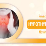 What are the Natural Ways to Manage Hypothyroidism?