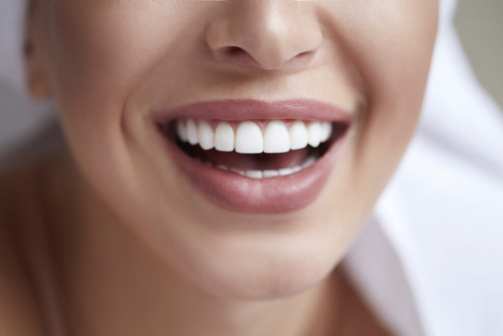 How Smile Makeover Treatment Can Give You a Picture-Perfect Smile