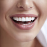 How Smile Makeover Treatment Can Give You a Picture-Perfect Smile