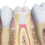 Best Root Canal Treatment: How Modern Dentistry Makes the Procedure Comfortable