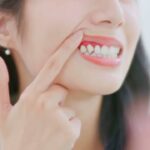 Dental Implants Affordable Diamond Bar: A Complete Guide to Restoring Your Smile