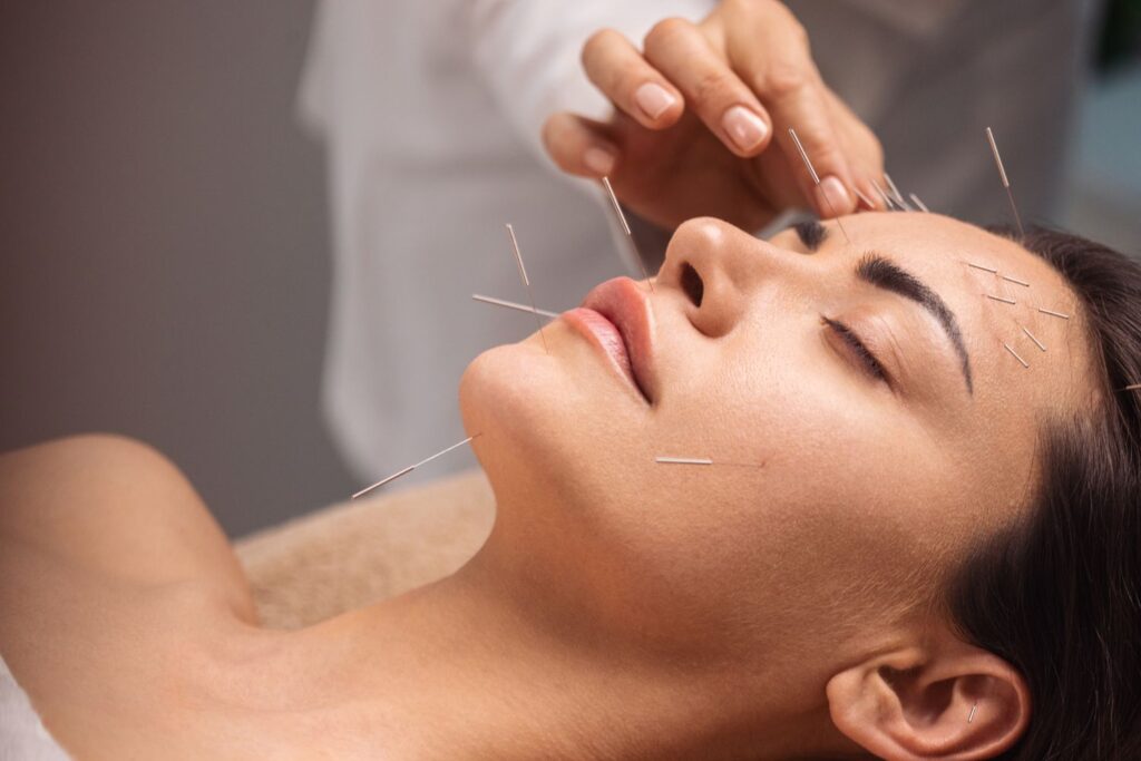 7 Skin Benefits of Cosmetic Acupuncture Facials
