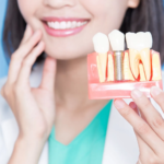 Restoring Your Smile: A Complete Guide to the Best Dental Implants in Badlapur