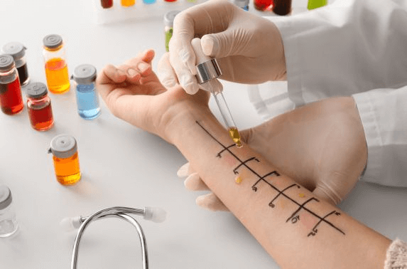Allergy Specialist Doctor in Dubai: Tips for Healthy Living