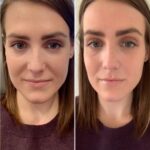 Best Plastic Surgeons in Dubai Transforming Hair PRP Treatment