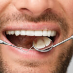 Why Preventive Dentistry at a Dental Clinic Matters