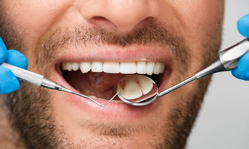Why Preventive Dentistry at a Dental Clinic Matters