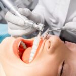 Teeth Cleaning Frequency Explained: When Should You Visit a Dentist?