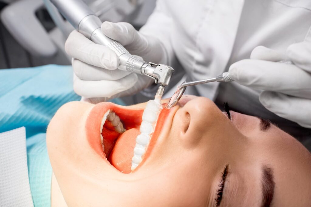 Teeth Cleaning Frequency Explained: When Should You Visit a Dentist?