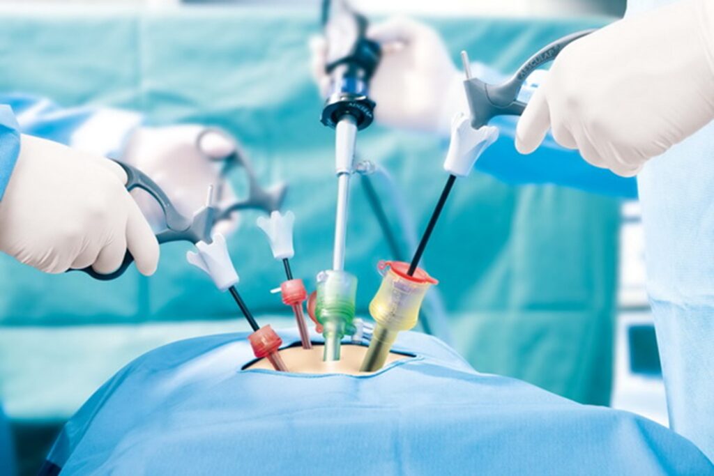How to Choose the Best Laparoscopic Surgeon in Dubai