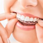 What Is the Minimum Invisalign Cost in Hadapsar?