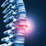 Correct Posture: The Foundation of Spinal Health and Long-Term Wellness