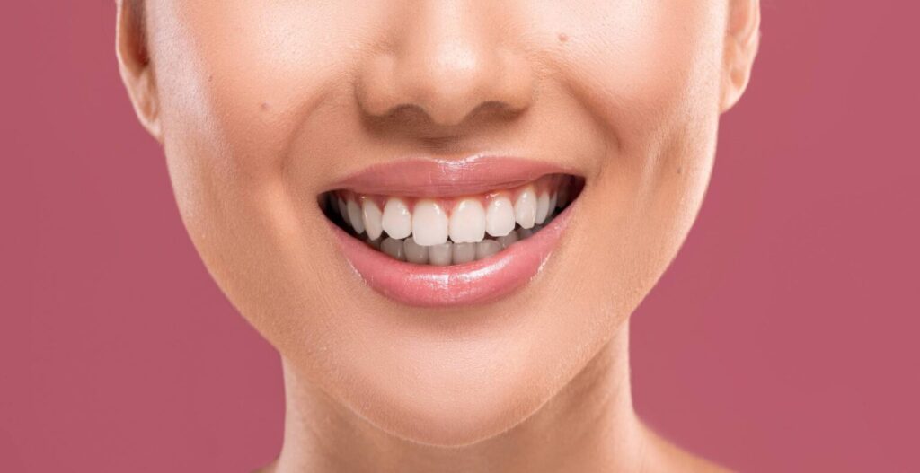 Three Major Reasons To Consider A Smile Makeover