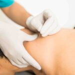 Find Lasting Relief from Headaches with Dry Needling