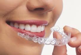 Aligners In Dubai Straighten Teeth Comfortably For Perfect Smile Transformation