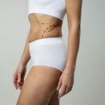 Choosing the Best Doctors in Dubai for Liposuction Procedures