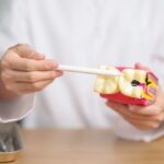 What to Eat After Wisdom Teeth Removal: Best Foods for Faster Healing