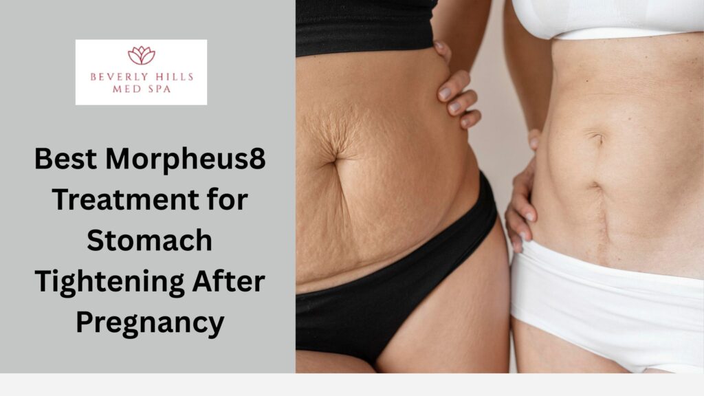 Best Morpheus8 Treatment for Stomach Tightening After Pregnancy