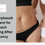 Best Morpheus8 Treatment for Stomach Tightening After Pregnancy