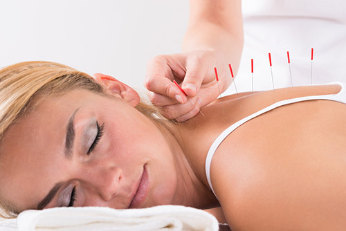 Post-Surgery Recovery with Orthopedic Acupuncture