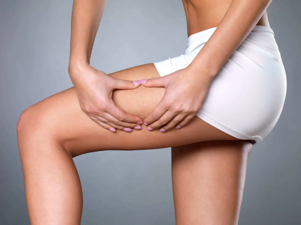 Thigh Lift in Jeddah Achieve Smooth and Toned Legs with Expert Surgery