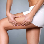 Thigh Lift in Jeddah Achieve Smooth and Toned Legs with Expert Surgery