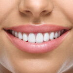 Modern Approaches to Enhancing Your Smile Designing in Parel Mumbai