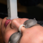 Soft Light Laser for Clearer Complexion