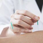 What Is Dry Needling Therapy? Benefits, Process, and How It Works