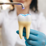 How are Tooth-Colored Fillings Better Than Metal?