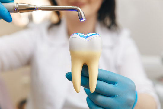How are Tooth-Colored Fillings Better Than Metal?