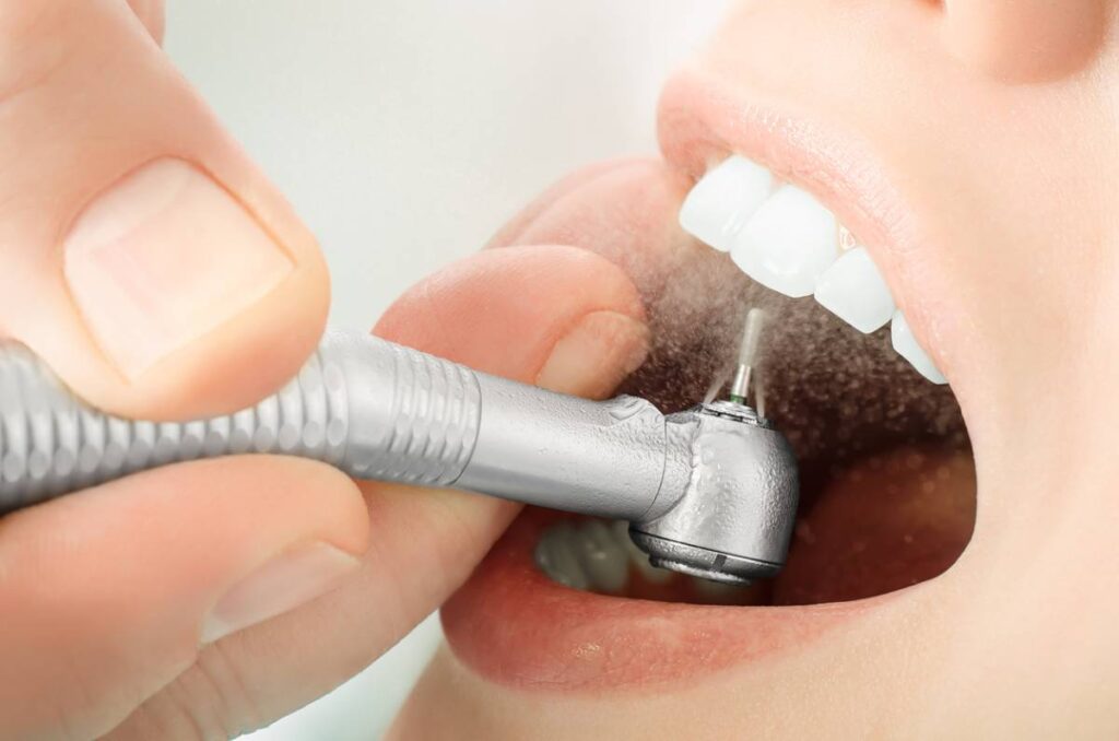 Why Teeth Cleaning Is Important for Healthy Teeth & Gums