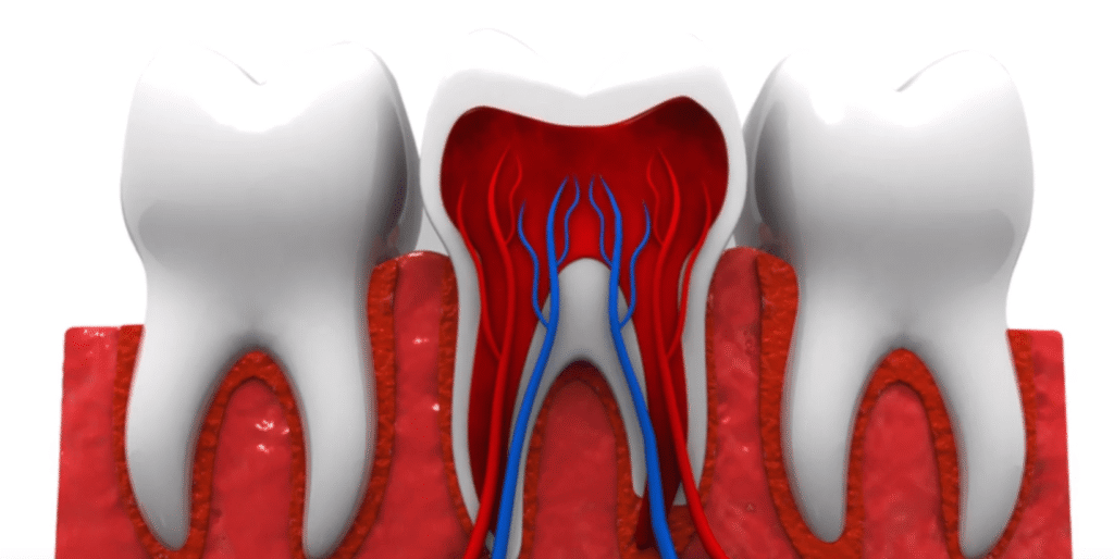 Best Root Canal Treatment in Bistupur Pain Relief Guide You Need