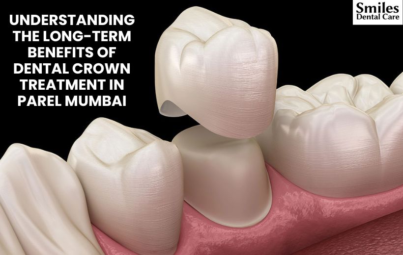Understanding the Long-Term Benefits of Dental Crown Treatment in Parel Mumbai