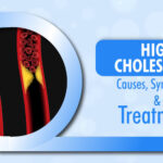 High Cholesterol: Symptoms, Causes and Treatment