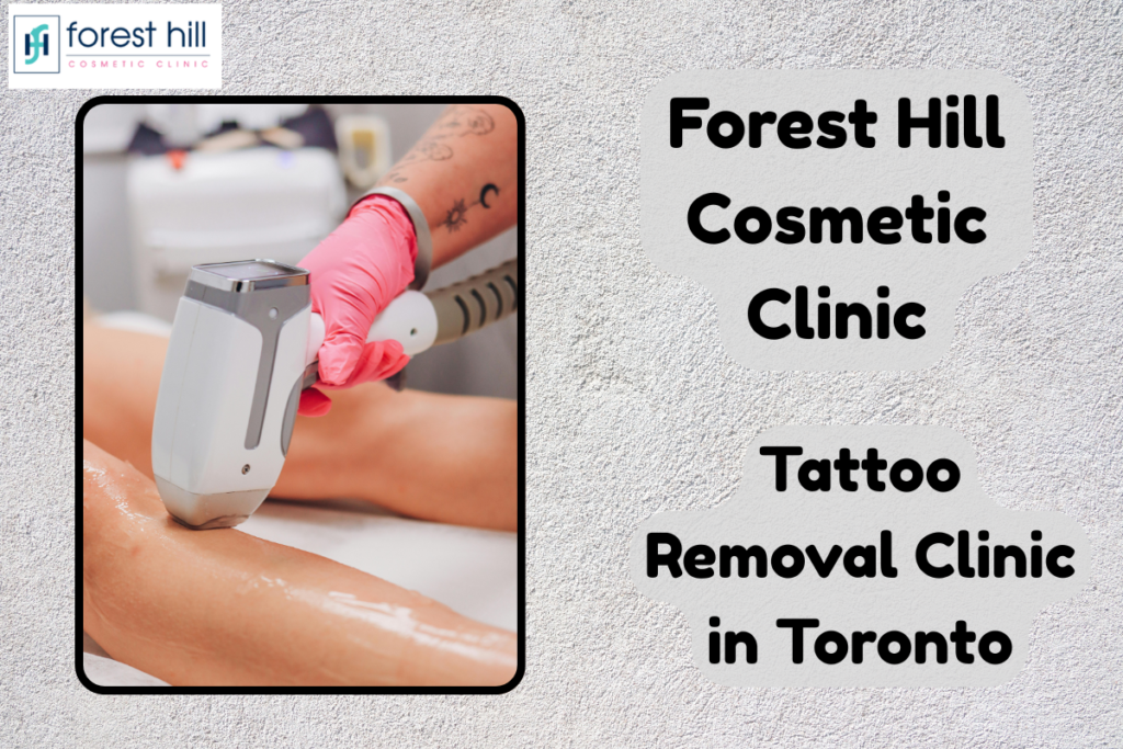 Tattoo Removal Clinic in Toronto: Safe & Effective Solutions at Forest Hill Cosmetic Clinic