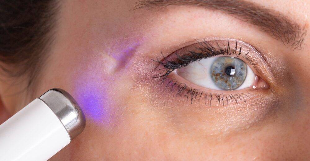 Scar Removal for Pigmentation and Texture Issues