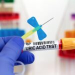 What Causes High Uric Acid Levels? Insights from Your Test
