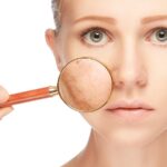 التصبغات في الرياض: أسباب تتجاوز التعرض للشمس