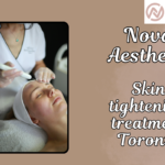 Skin Tightening Treatment Toronto: Restore Firm, Youthful Skin Without Surgery