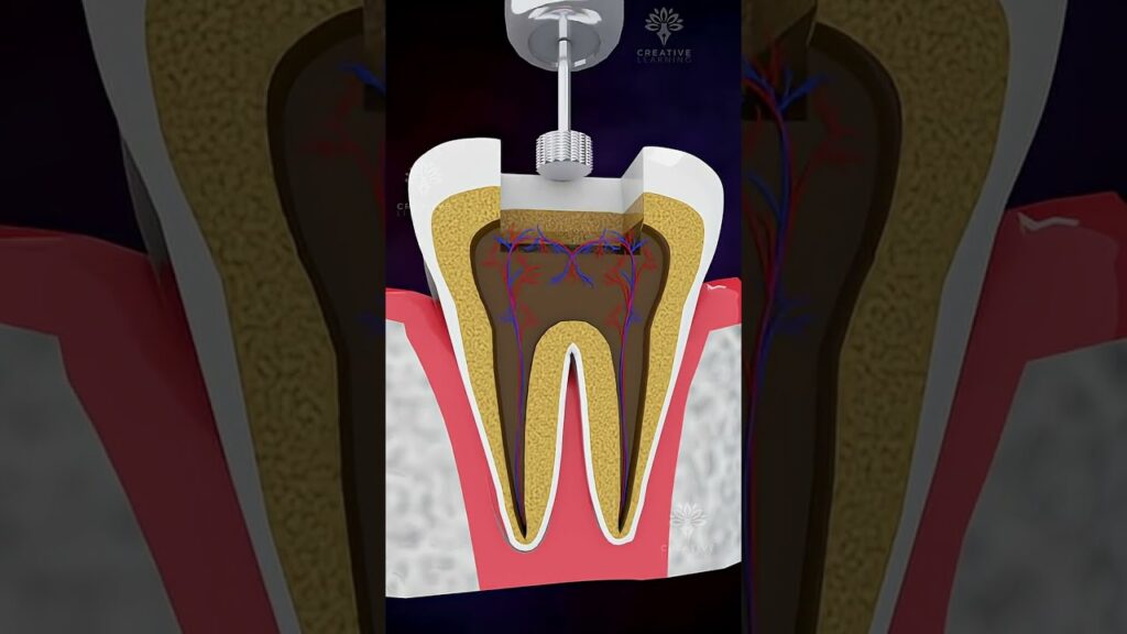 Root Canal Treatment Cost for Front and Back Teeth Guide