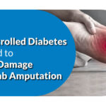 How Uncontrolled Diabetes Can Lead to Nerve Damage and Limb Amputation