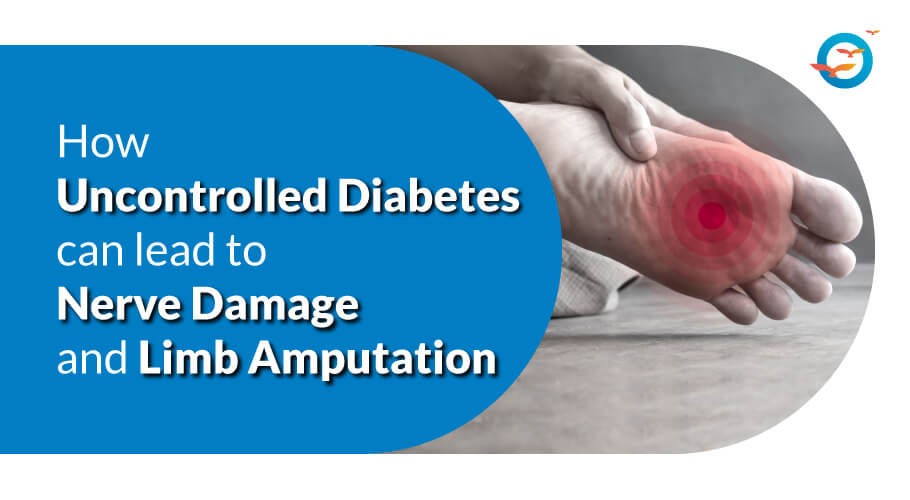 How Uncontrolled Diabetes Can Lead to Nerve Damage and Limb Amputation