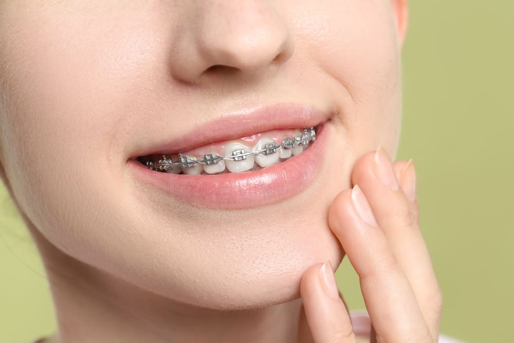 Confused About Braces? A Guide to the Best Treatment in Nagpur