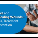 Diabetes and Wound Healing: Reasons, Treatment and Prevention
